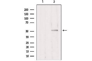 Western blot analysis of extracts from Hepg2, using TRIM38 Antibody. (TRIM38 抗体  (Internal Region))