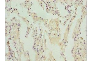 Immunohistochemistry of paraffin-embedded human lung tissue using ABIN7171726 at dilution of 1:100 (ZBTB48 抗体  (AA 1-280))