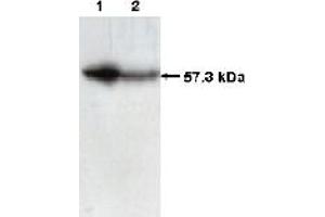 Western Blotting (WB) image for anti-Chaperonin Containing TCP1, Subunit 2 (Beta) (CCT2) (C-Term) antibody (ABIN264513) (CCT2 抗体  (C-Term))
