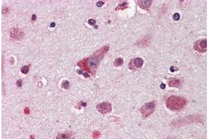 Anti-ELOVL5 antibody  ABIN960769 IHC staining of human brain, cortex. (ELOVL5 抗体  (Internal Region))