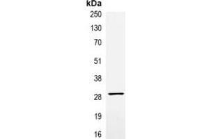 Immunoprecipitation of VSV-G-tagged protein from HEK293T cells transfected with vector overexpressing VSV-G tag, using Anti-VSV-G-tag Antibody. (VSV-g Tag 抗体)