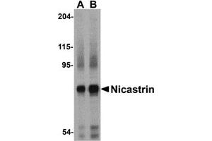 Western Blotting (WB) image for anti-Nicastrin (NCSTN) (Middle Region) antibody (ABIN1031014) (Nicastrin 抗体  (Middle Region))