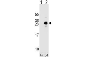 Western Blotting (WB) image for anti-Sclerostin (SOST) antibody (ABIN2912280) (Sclerostin 抗体)