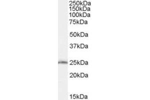 Western Blotting (WB) image for anti-SAR1 Homolog B (SAR1B) (AA 104-116) antibody (ABIN292166) (SAR1B 抗体  (AA 104-116))