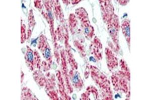 Immunohistochemistry (IHC) image for anti-Aconitase 2, Mitochondrial (ACO2) (AA 438-467) antibody (ABIN5647449)