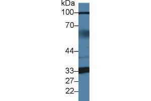 Detection of ZBP1 in Human Serum using Polyclonal Antibody to Z-DNA Binding Protein 1 (ZBP1) (ZBP1 抗体  (AA 10-167))