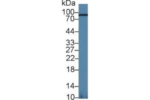 Western Blot; Sample: Mouse Kidney lysate; Primary Ab: 1. (Aconitase 1 抗体  (AA 527-719))