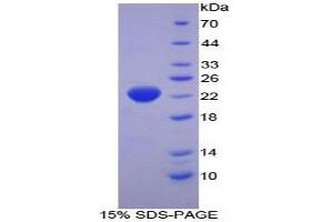 SDS-PAGE analysis of Human Interferon alpha 2 Protein. (IFNA2 蛋白)