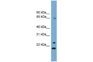 WB Suggested Anti-ZNF37A Antibody Titration:  0. (ZNF37A 抗体  (Middle Region))