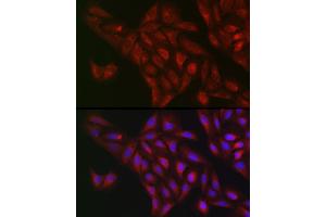Immunofluorescence analysis of U2OS cells using NQO1 Rabbit pAb (ABIN1681096, ABIN3015018, ABIN3015019 and ABIN6213595) at dilution of 1:50 (40x lens). (NQO1 抗体  (AA 1-274))