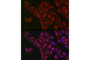 Immunofluorescence analysis of U2OS cells using NQO1 Rabbit pAb (ABIN1681096, ABIN3015018, ABIN3015019 and ABIN6213595) at dilution of 1:50 (40x lens). (NQO1 抗体  (AA 1-274))