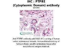 Image no. 1 for anti-Protein tyrosine Phosphatase, Receptor Type, E (PTPRE) (Cytoplasmic Domain) antibody (ABIN1738608) (PTPRE 抗体  (Cytoplasmic Domain))