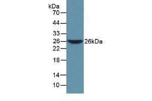 Detection of Recombinant WARS, Mouse using Polyclonal Antibody to Tryptophanyl tRNA Synthetase (WARS) (WARS 抗体  (AA 29-195))