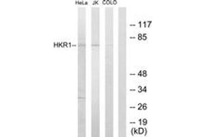Western blot analysis of extracts from HeLa/Jurkat/COLO205 cells, using HKR1 Antibody. (HKR1 抗体  (AA 141-190))