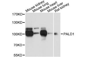 Western blot analysis of extracts of various cell lines, using PALD1 antibody. (KIAA1274 抗体)
