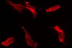 ABIN6274674 staining HeLa by IF/ICC. (IL20RB 抗体  (Internal Region))