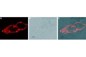 Immunocytochemistry (ICC) image for anti-Potassium Intermediate/small Conductance Calcium-Activated Channel, Subfamily N, Member 4 (KCNN4) (Extracellular) antibody (ABIN7044556)