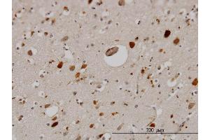 Immunoperoxidase of monoclonal antibody to PTN on formalin-fixed paraffin-embedded human cerebral cortex. (Pleiotrophin 抗体  (AA 45-154))