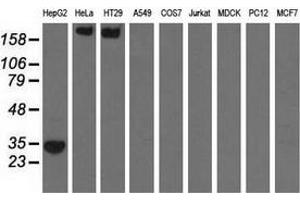 Western blot analysis of extracts (35 µg) from 9 different cell lines by using anti-SULT2A1 monoclonal antibody. (SULT2A1 抗体)