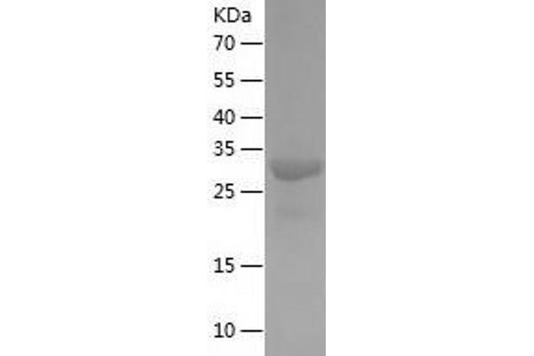 ECHDC1 Protein (AA 1-307) (His tag)