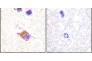 Immunohistochemistry analysis of paraffin-embedded human brain, using PLCG2 (Phospho-Tyr1217) Antibody. (Phospholipase C gamma 2 抗体  (pTyr1217))