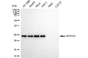 Western blotting analysis using MRPS26 antibody (ABIN7799434). (Recombinant MRPS26 抗体)