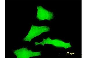 Immunofluorescence of monoclonal antibody to RAB31 on HeLa cell. (RAB31 抗体  (AA 96-195))