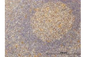 Image no. 1 for anti-Mediator Complex Subunit 21 (MED21) (AA 1-145) antibody (ABIN599079) (MED21 抗体  (AA 1-145))