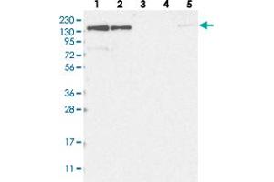 Western blot analysis of Lane 1: RT-4, Lane 2: U-251 MG, Lane 3: Human Plasma, Lane 4: Liver, Lane 5: Tonsil with NUP153 polyclonal antibody  at 1:250-1:500 dilution.