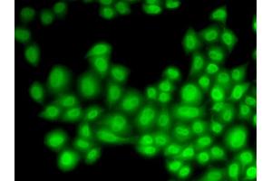 Immunofluorescence (IF) image for anti-Cullin 4B (CUL4B) antibody (ABIN1876588) (Cullin 4B 抗体)