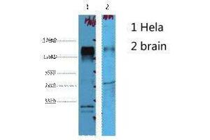 Western Blot (WB) analysis of 1) HeLa, 2) Mouse Brain, diluted at 1:4000. (ErbB2/Her2 抗体)