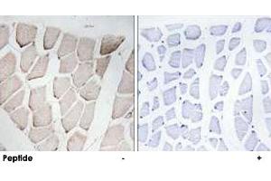 Immunohistochemistry analysis of paraffin-embedded human skeletal muscle tissue using MYOM1 polyclonal antibody . (Myomesin 1 抗体)