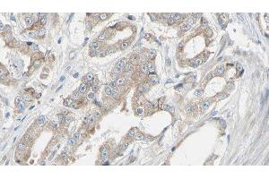 ABIN6278390 at 1/100 staining Human prostate tissue by IHC-P. (EIF3B 抗体)