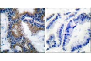 Immunohistochemistry (IHC) image for anti-V-Crk Sarcoma Virus CT10 Oncogene Homolog (Avian)-Like (CRKL) (AA 173-222), (pTyr207) antibody (ABIN1531223)