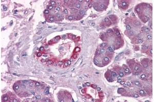 Human Pancreas: Formalin-Fixed, Paraffin-Embedded (FFPE) (DUSP6 抗体  (AA 1-382))