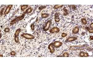 Detection of EPCAM in Porcine Uterus Tissue using Polyclonal Antibody to Epithelial Cell Adhesion Molecule (EPCAM)