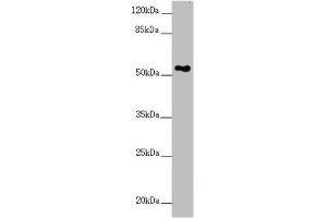 Western blot All lanes: FOXRED1 antibody at 5. (FOXRED1 抗体  (AA 307-486))