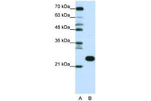 WB Suggested Anti-RPL13 Antibody Titration:  0. (RPL13 抗体  (C-Term))