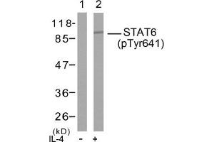 Image no. 2 for anti-Signal Transducer and Activator of Transcription 6, Interleukin-4 Induced (STAT6) (pTyr641) antibody (ABIN196700)