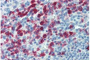 Human Spleen: Formalin-Fixed, Paraffin-Embedded (FFPE) (SELPLG 抗体)