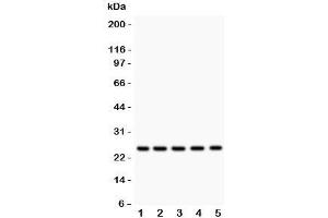 Western blot testing of HSP27 antibody and Lane 1:  rat NRK;  2: human HeLa;  3: (h) A549;  4: (h) COLO320;  5: (h) HEPG2 lysate. (HSP27 抗体  (AA 1-205))