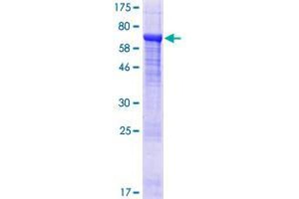 Diphthamide Biosynthesis 7 (DPH7) (AA 1-452) protein (GST tag)