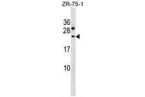 CCDC140 Antibody (N-term) western blot analysis in ZR-75-1 cell line lysates (35µg/lane). (CCDC140 抗体  (N-Term))