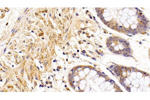 Detection of TUBb in Human Colon Tissue using Anti-Tubulin Beta (TUBb) Monoclonal Antibody (TUBB 抗体  (AA 170-419))