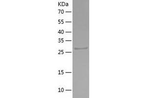 ETS1 Protein (AA 1-272) (His tag)