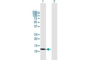 Western Blot analysis of GNLY expression in transfected 293T cell line by GNLY MaxPab polyclonal antibody.