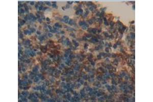 Immunohistochemistry (Paraffin-embedded Sections) (IHC (p)) image for anti-Tumor Necrosis Factor Receptor Superfamily, Member 4 (TNFRSF4) (AA 29-210) antibody (ABIN2904421)