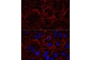 Confocal immunofluorescence analysis of U2OS cells using Septin 9 Polyclonal Antibody (ABIN6129127, ABIN6147560, ABIN6147561 and ABIN6224744) at dilution of 1:100. (Septin 9 抗体  (AA 1-110))