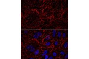 Confocal immunofluorescence analysis of U2OS cells using Septin 9 Polyclonal Antibody (ABIN6129127, ABIN6147560, ABIN6147561 and ABIN6224744) at dilution of 1:100. (Septin 9 抗体  (AA 1-110))