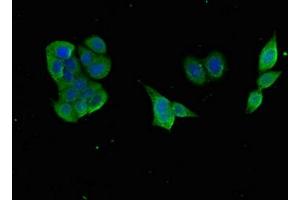 Immunofluorescent analysis of PC-3 cells using ABIN7153517 at dilution of 1:100 and Alexa Fluor 488-congugated AffiniPure Goat Anti-Rabbit IgG(H+L) (GABARAPL1 抗体  (AA 1-117))